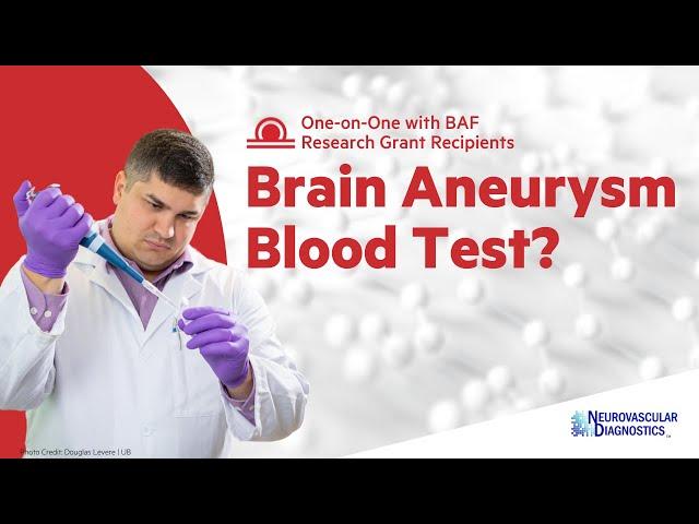 Diagnosing unruptured brain aneurysms with a blood test - Vincent Tutino explains | BAF