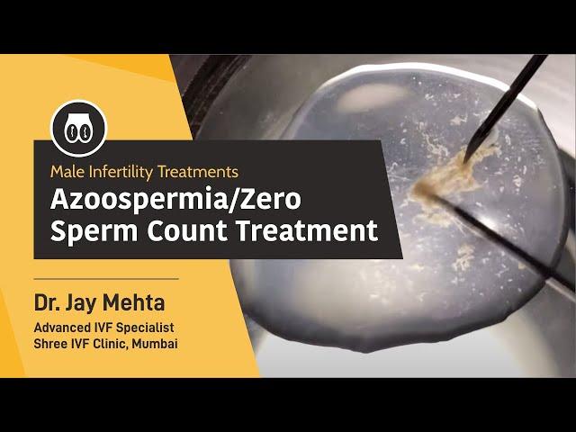 Azoospermia/Zero Sperm Count Treatment | TEFNA | Male Infertility Treatment | Dr Jay Mehta, Mumbai