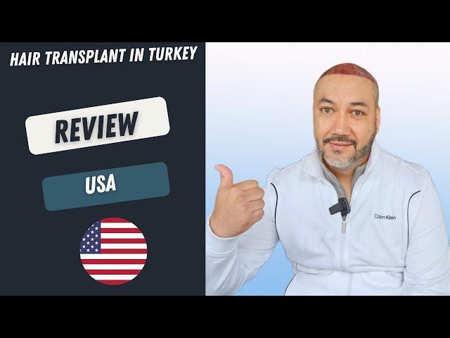 Hair Transplant in Turkey Review l Worbimed Clinic