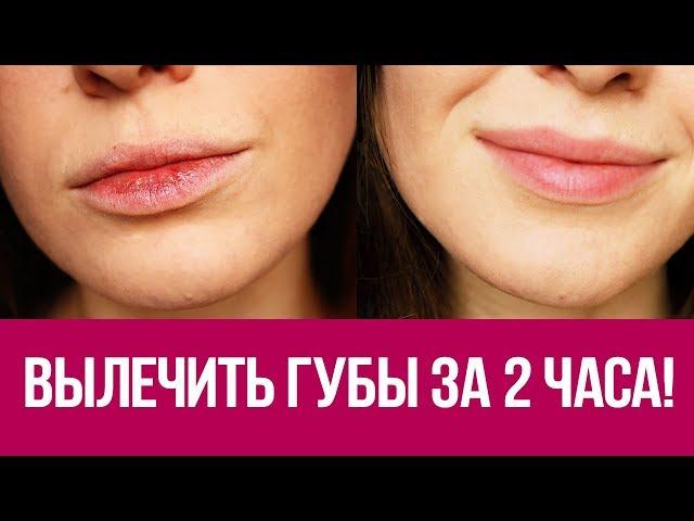  Как быстро восстановить губы? Экспресс вариант за 2 часа! 