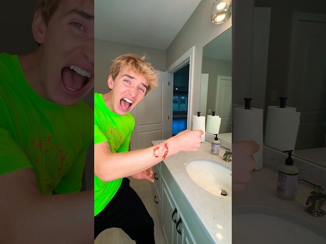 Super realistic fake wound PRANK! (GROSS)