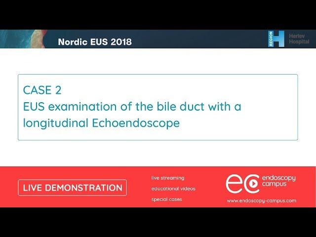 Livedemo | Nordic EUS 2018 | EUS examination of the bile duct with a longitudinal Echoendoscope