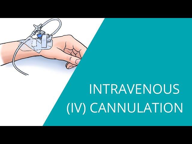 Intravenous IV Cannulation - how to prepare and insert an intravenous fluid line