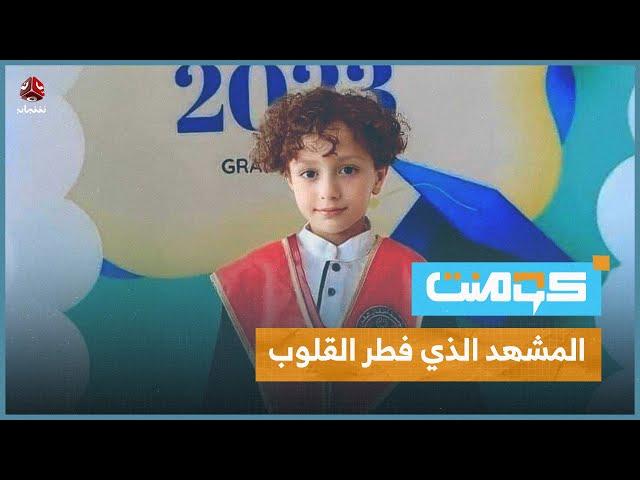 حكاية أبو شعر كيرلي الذي أبكى العالم .. قصة لا تنسى | كومنت