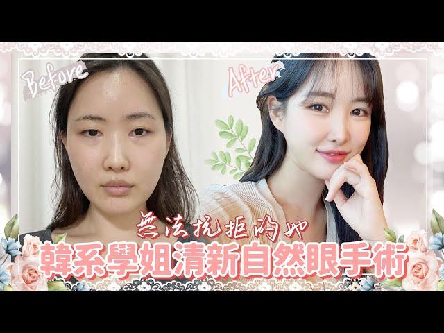 韓系學姐清新自然眼手術 ｜韓國必嫵整形醫院View Plastic Surgery