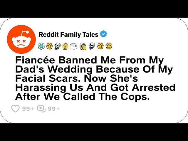 Fiancée Banned Me From My Dad's Wedding Because Of My Facial Scars. Now....- Reddit Stories