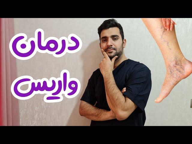 پیشگیری و درمان واریس | varicose veins treatment