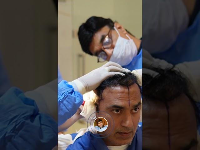 Today's procedures at Hair Club: FUE Hair Transplant with DHI technology.