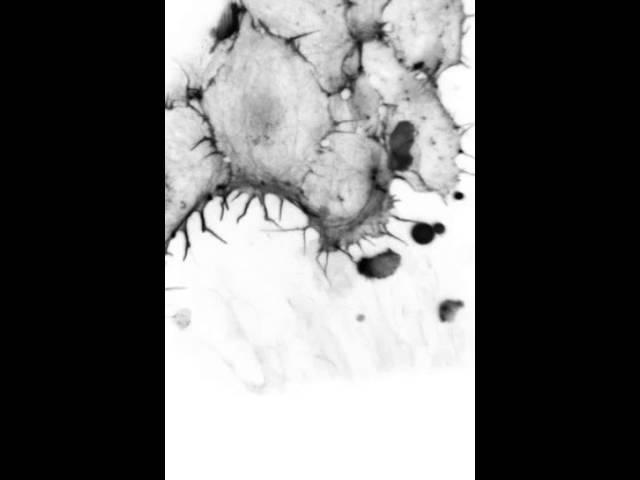 Migrating endothelial cells in a zebrafish embryo
