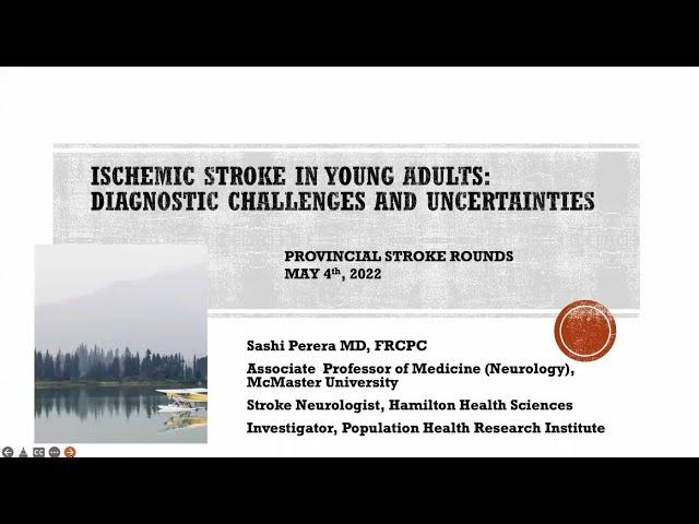 Ischemic Stroke in Young Adults: Diagnostic Challenges and Uncertainties