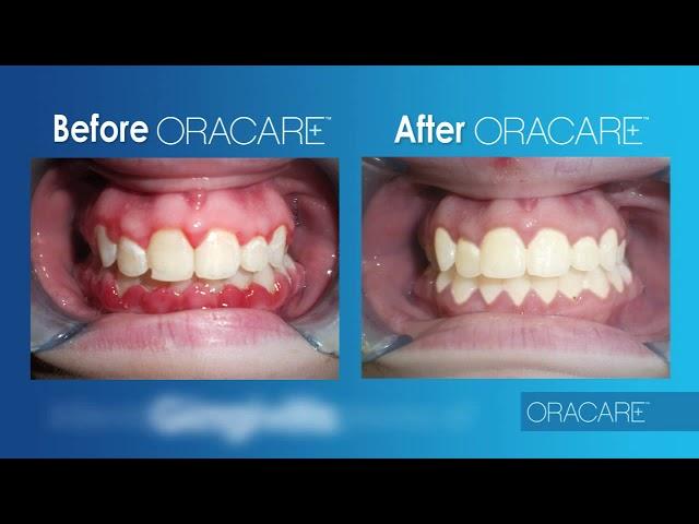 Dr Rashmi Kumra  Dentist Select introduces OraCare ™Dr Rashmi Kumra