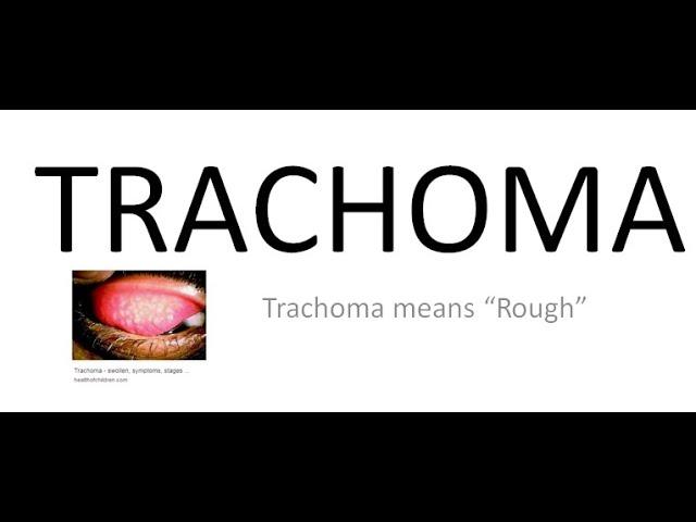 Ophthalmology 076 a Trachoma What is Chlamydial Trachomatis Conjunctivitis