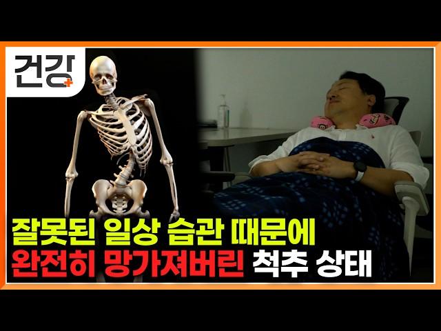 나도 모르게 다리 꼬고, 이상하게 앉았던 행동들이 척추측만증이 되어 돌아왔다｜척추측만증 집에서 수술 없이 고치는 법｜귀하신 몸｜#EBS건강