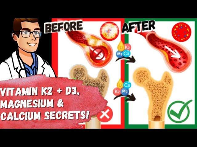 Vitamin K2 & Vitamin D3 NEW SECRETS! [+ Magnesium & Calcium MISTAKES]