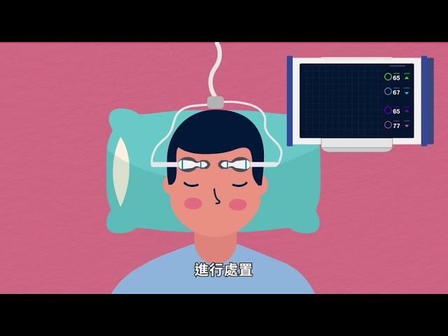 腦氧監測 Brain Oximetry | 區域氧飽和度監測