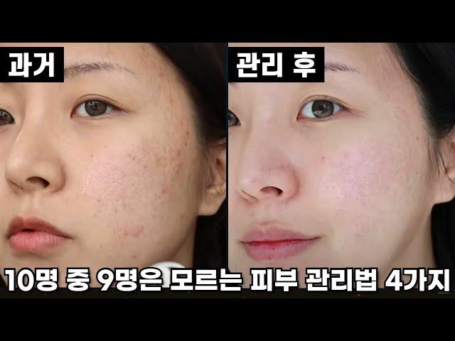 여름 피부 진짜 좋아지려면 이거 4가지는 죽어라 하세요