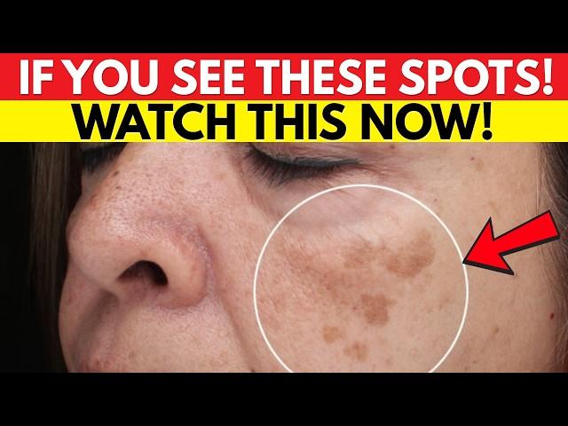 The #1 Mineral You Need to Prevent Age Spots According to Experts