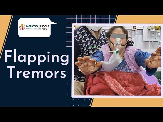 flapping tremors l asterixis | #tremors  #liverfailure  #hepatology  #braindisorder
