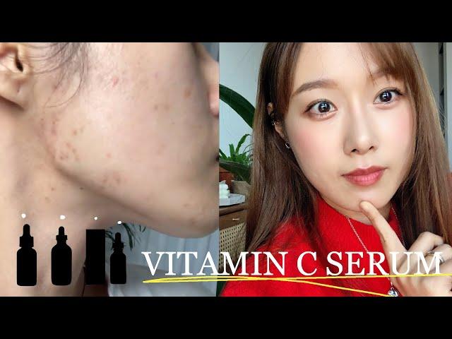 Why are you not using it...?Use it please!!! (No ads) Everything about Vitamin C Serum! LUCY PARK