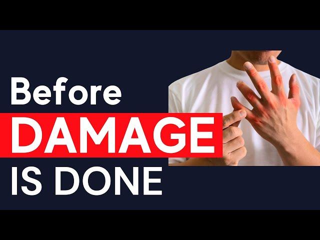 PAINFUL Psoriatic Arthritis Inflammation: How To STOP It | Dr. Jenny Bennett