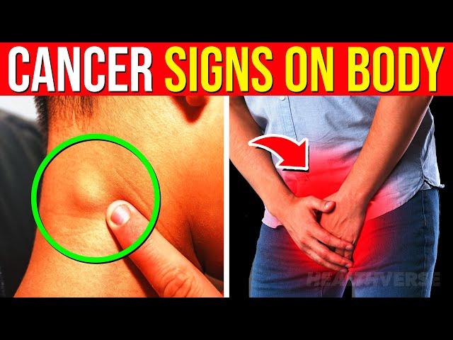 10 Early CANCER SIGNS On Your Body You Must CATCH Before It's Too Late