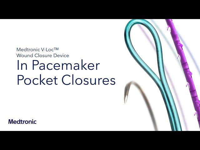 V-Loc™ Wound Closure Device Testimonial - Dr. Niazi in Pocket Closures
