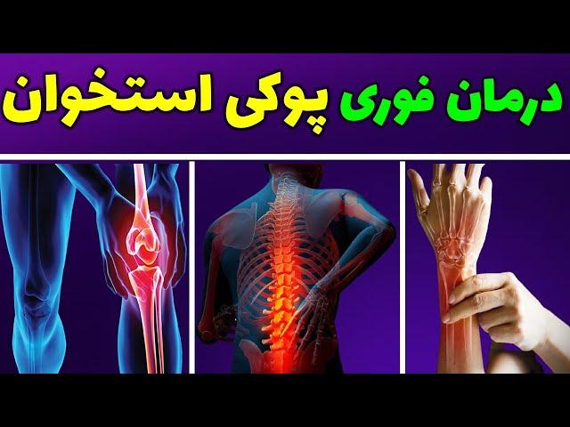 پوکی استخوان چیست|درمان پوکی استخوان|درمان فوری پوکی استخوان درخانه