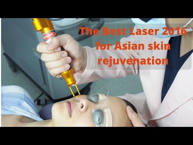 Best Laser for Asian Skin Rejuvenation