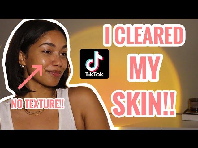 My VIRAL TikTok Skincare Routine! How To GET RID OF TEXTURED SKIN!! | No More Tiny Bumps