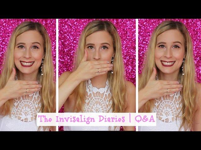 The Invisalign Diaries | Q&A