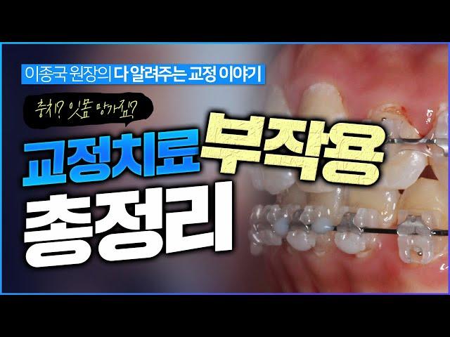 교정치료 부작용  6가지 총정리!!  예비 교정의사분들도 꼭 보세요 [치근흡수,턱관절,잇몸질환 등]