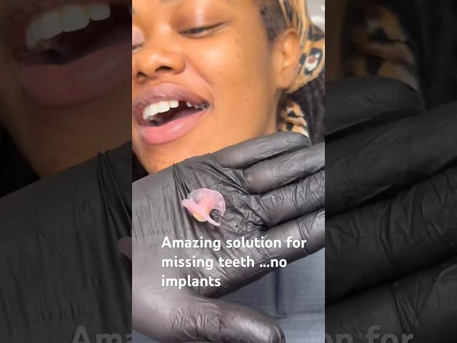 Amazing solution for missing teeth ! No implants and you can eat with it !