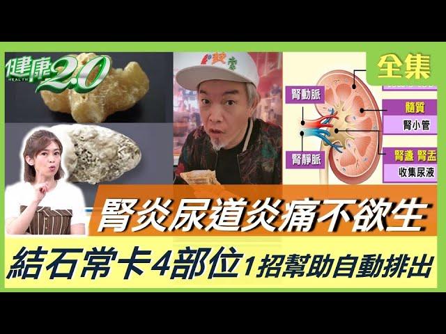 腎臟炎 腎結石痛到打滾！ 尿路結石常卡在4部位 這一招讓腎結石自動排出！7種健康加料水 讓你愛上喝水 健康2.0 20230702【完整版】鄭凱云 洪永祥 洪峻澤 黃淑惠 陳玲玲 彥寬