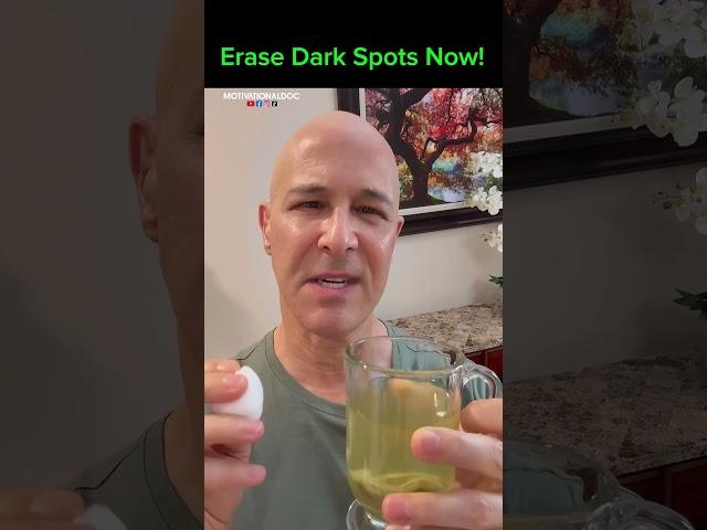 Erase Dark Spots Now!  Dr. Mandell