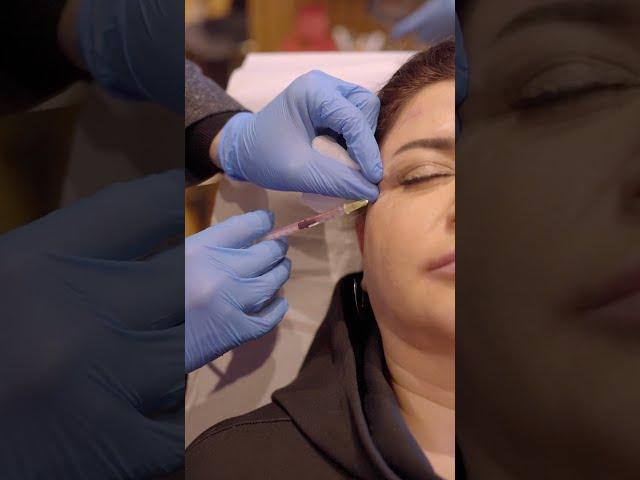 Botox Uygulama Adımları - Kırışıklara Son Verin! #botoks #botox