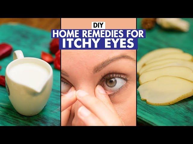 Home Remedies For Itchy Eyes   DIY   Fit Tak