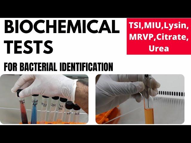 Biochemical Tests for Bacterial Identification (Part-1)_TSI, MIU, MR-VP, Lysin, Urea, Citrate