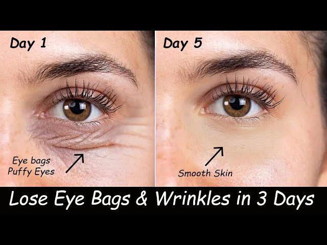 Remove Under Eyebags & Eye Wrinkles in 3 Days - Vaseline for Dark Circles, Carrot Gel & Eye Exercise