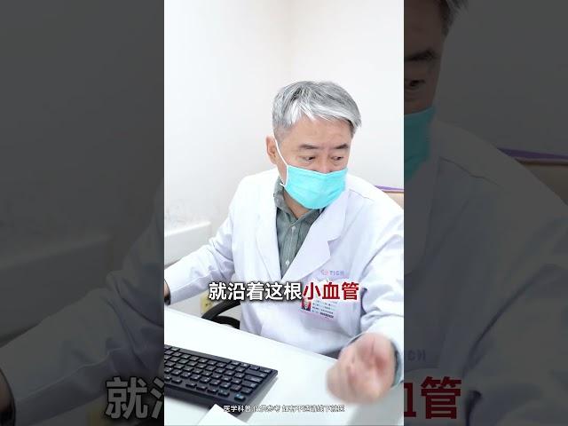 射频消融治愈早搏 “懒病”却意外发作 射频消融 早搏 射频消融 定心丸张峰医生 泰达国际心血管病医院