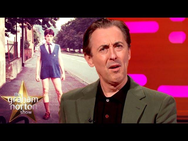 Alan Cumming's Embarrassing School Picture | The Graham Norton Show