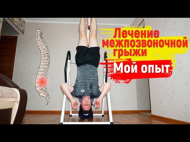 Treatment of intervertebral hernia. My experience. Exercises, recommendations + inversion table.