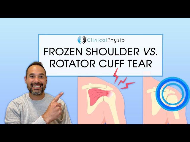 What is the Difference Between Frozen Shoulder And Rotator Cuff Tear? | Expert Physio Guide