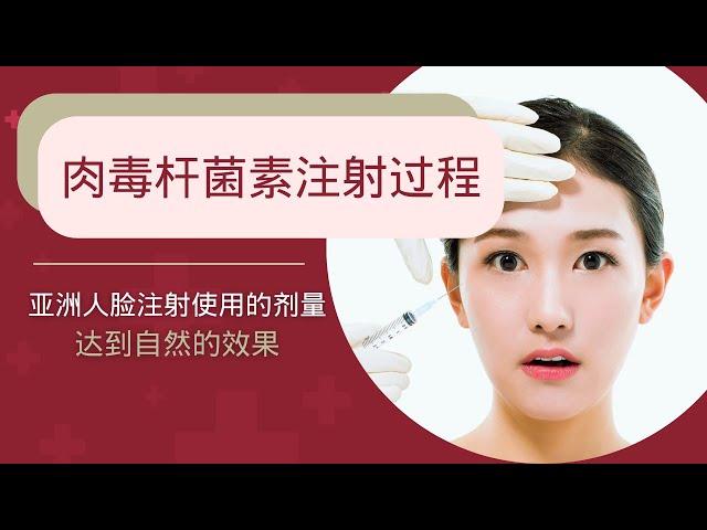 How to Get Rid of Wrinkles Effectively | 肉毒杆菌注射过程 | Anna Hoo Clinic