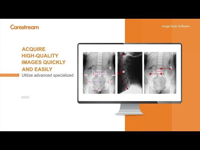 Carestream Image Suite V4 MR10