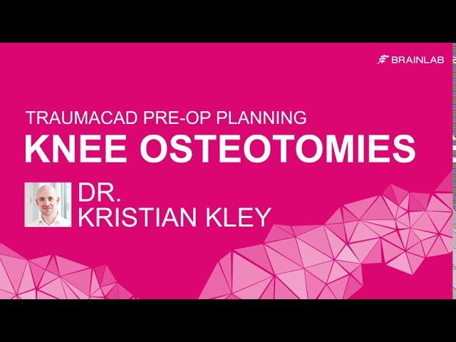 Knee Osteotomies Planning with TraumaCad, by Dr. Kristian Kley