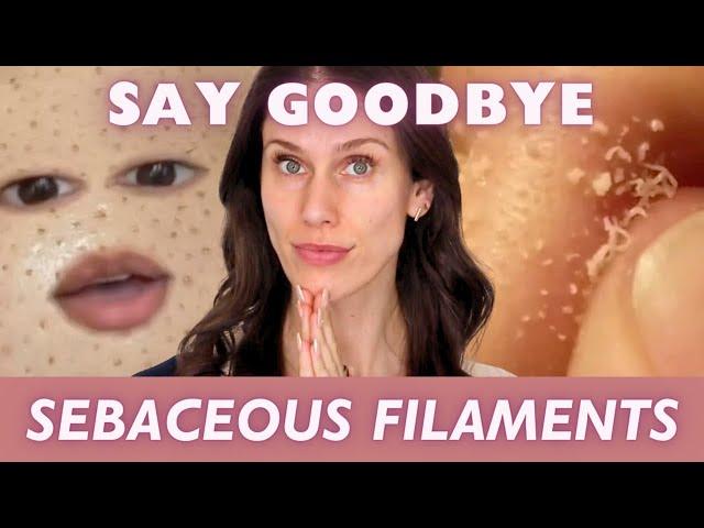 How To Get Rid Of Sebaceous Filaments