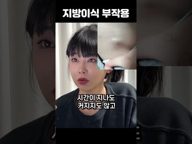 지방이식하다가 콩알이.. 의사선생님도 처음본다는 부작용 (ft.지방이식 부작용 )
