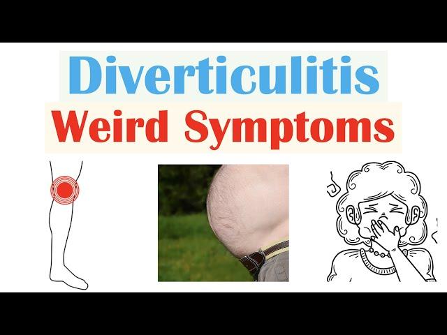 Weird Symptoms of Diverticulitis | Atypical Clinical Features of Diverticulitis