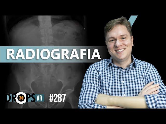 RADIOGRAFIA - COMO FUNCIONA?