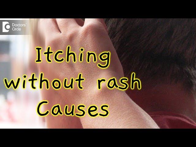 What causes itching all over without a rash? - Dr. Rasya Dixit